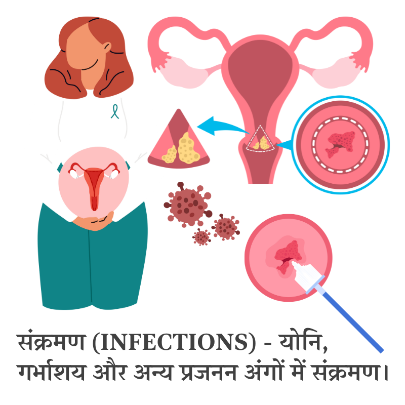 योनि और प्रजनन अंगों में संक्रमण